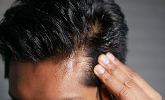 Understanding Men's Hair Thinning: Causes and Science Behind Hair Loss